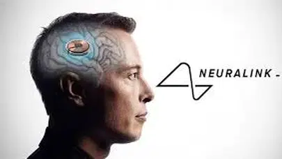 Elon Musk, Neuralink ile İnsan Beynine Kablosuz Çip Enjeksiyonunu Başarıyla Gerçekleştirdi!