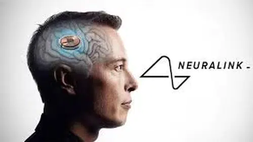 Elon Musk, Neuralink ile İnsan Beynine Kablosuz Çip Enjeksiyonunu Başarıyla Gerçekleştirdi!