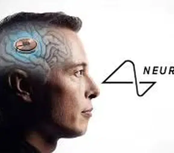 Elon Musk, Neuralink ile İnsan Beynine Kablosuz Çip Enjeksiyonunu Başarıyla Gerçekleştirdi!